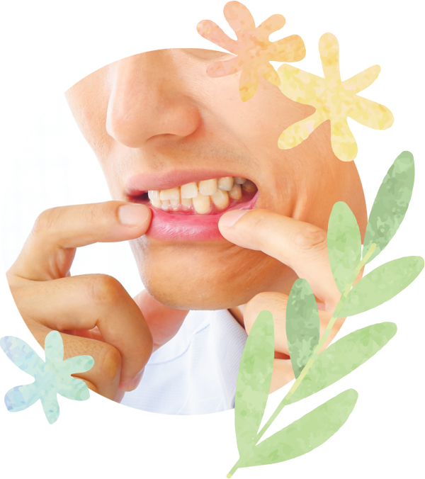 歯周病は、古くは「歯槽膿漏」などとも呼ばれました。様々な疾病の原因になります。